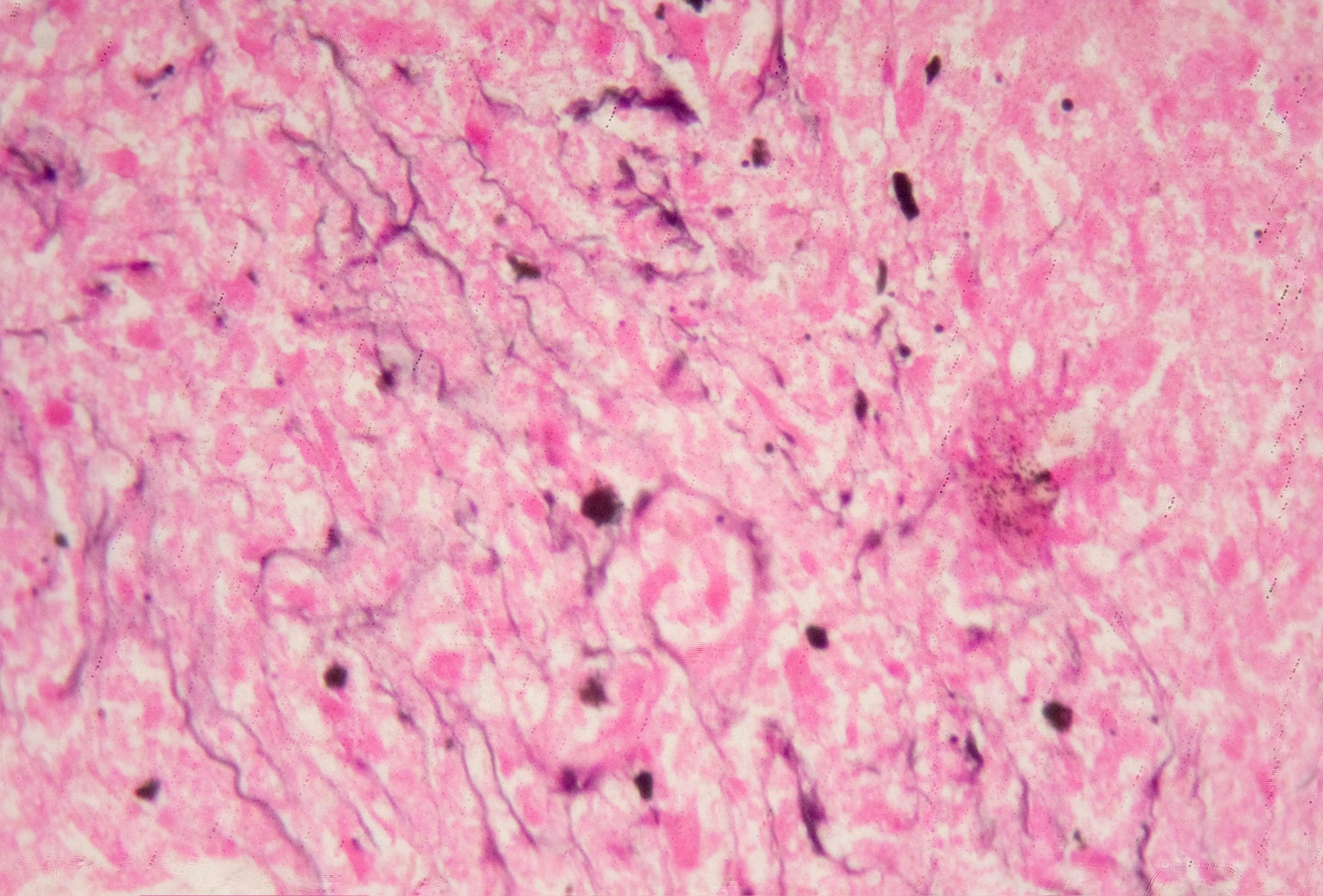 Microscopic view of Histoplasma capsulatum