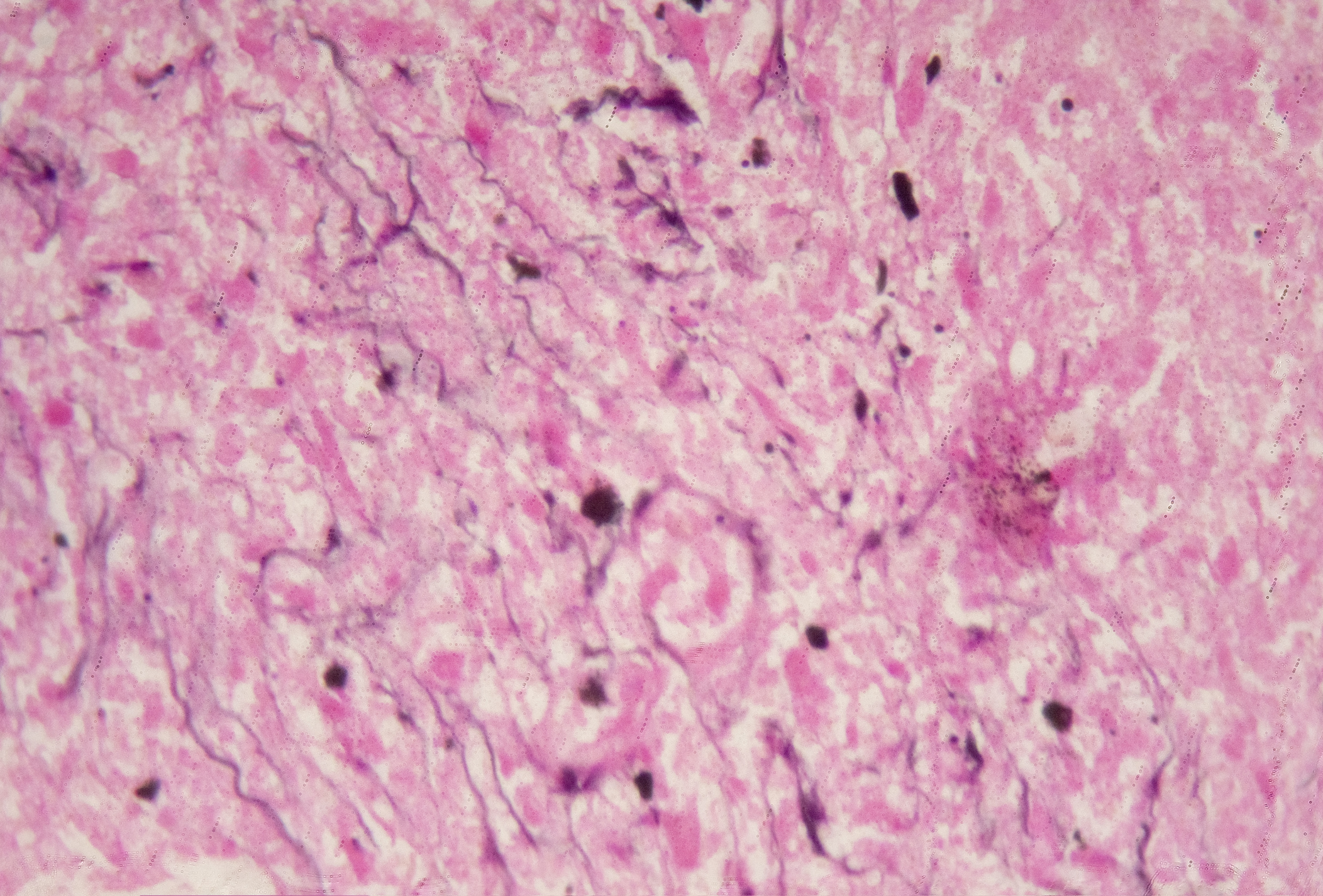 Microscopic view of Histoplasma capsulatum