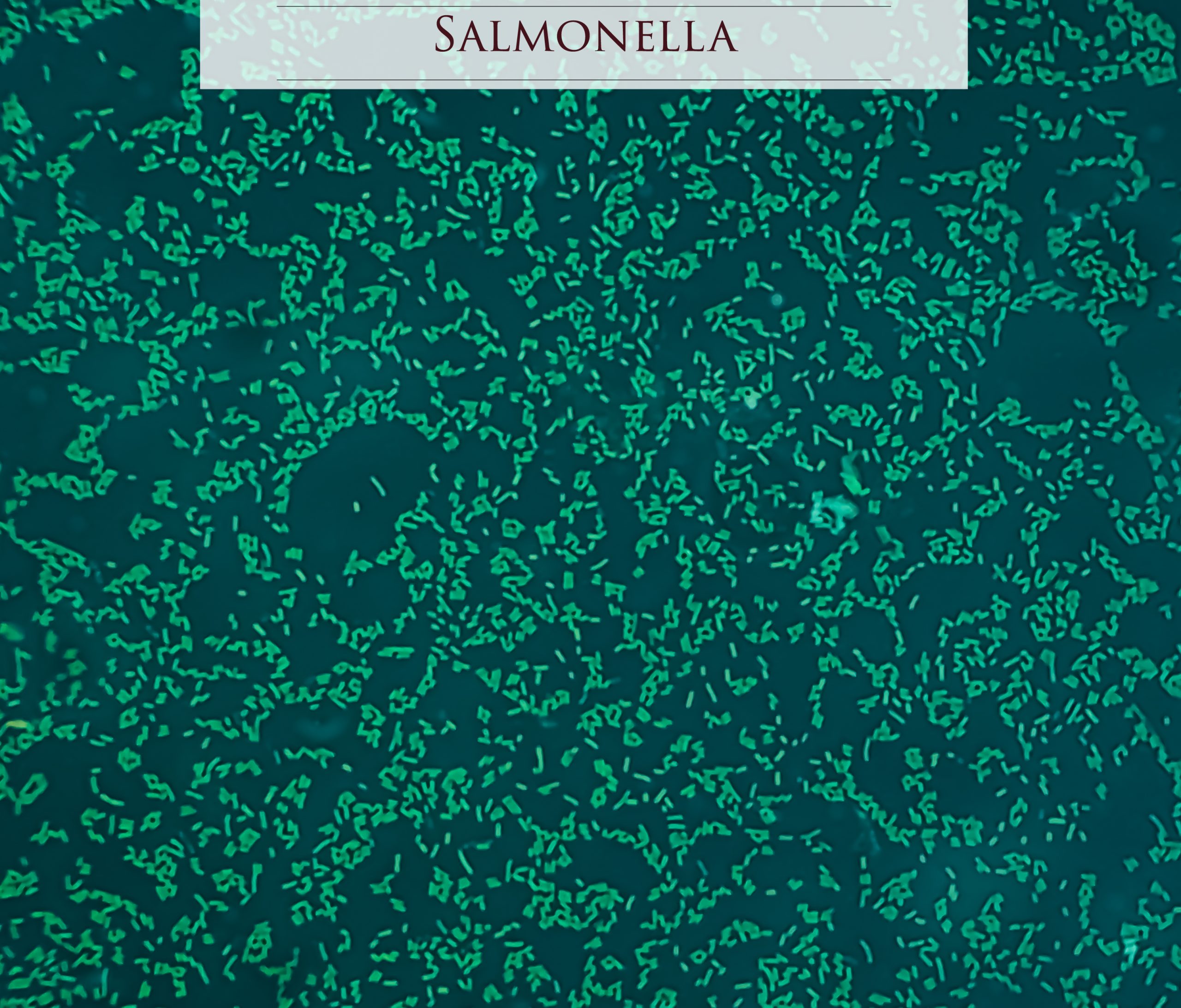 Microscopic view of gram stained slide from blood agar salmonella colonies