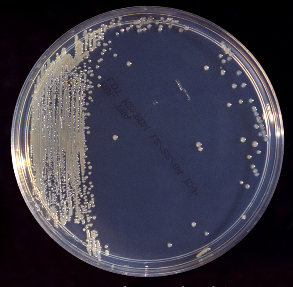 This inoculated trypticase soy broth (TSB) agar cultivated colonial growth of Enterobacter sakazakii bacteria that were slightly yellowish in color.